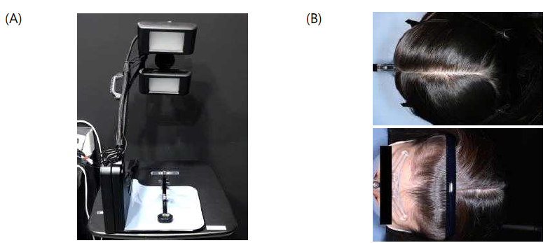 (A) Global hair device(Canfield Scientific Inc., USA) (B) 사진 예시(피험자번호: CT22-1000-S13)