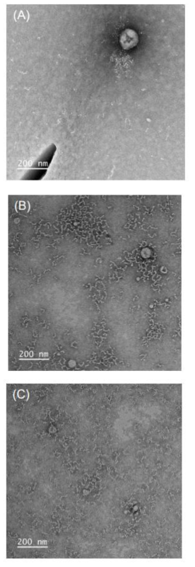 동결건조에 의해 제조된 투과전자현미경-SNP 복합체(A), 조효소 Q10-SNP 복합체(B) 및 D-δ-토코페롤-SNP 복합체(C)