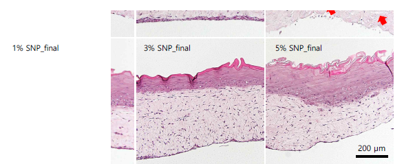 SNP_final과 대조물질을 24시간 노출시킨 3D 인공피부 H&E 분석 이미지