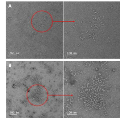 (A) D.W. 및 (B) 1 M Sodium phosphate buffer(pH 7)에 분산된 SNP의 투과 전자 현미경 사진