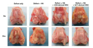 연골 손상 후, 하이드로겔 단독, 제대혈 유래 줄기세포와 하이드로겔 복합체 및 태반유래 고유효성 줄기세포와 하이드로겔 복합체를 이식 후, 연골 재생 확인