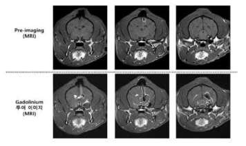기기의 뇌내 삽관 정확도 확인을 위한 MRI 영상