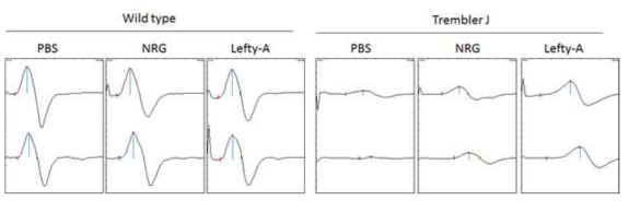 전기생리학적 검사를 통한 Trembler J 마우스에서 lefty-A의 치료효능