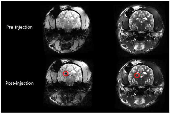 IBI를 활용한 줄기세포 뇌내 투여 MRI 영상 (붉은 표시가 줄기세포)