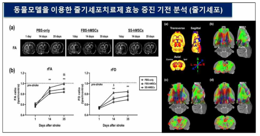 DTI 영상분석을 통한 줄기세포치료제 효능 증진 분석