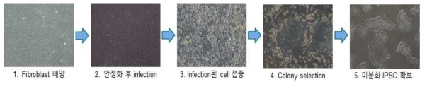 정상인 및 CMT1A 환자유래 세포로부터 iPSC 제작