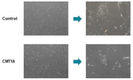 분화유도 및 sorting 후 cell morphology