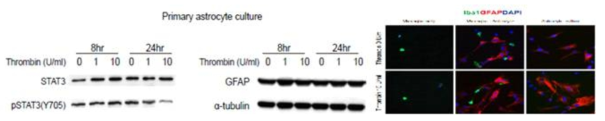 출혈성 체외 모델에서 glial/astrocyte culture에서 STAT3 활성화