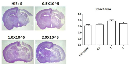 신생아 허혈성 뇌질환 모델에서 투여량 비교