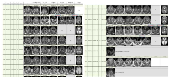 등록환자 뇌영상 평가 자료