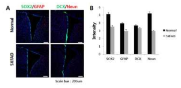 5XFAD의 신경줄기세포 증식능 및 분화능 저하 확인