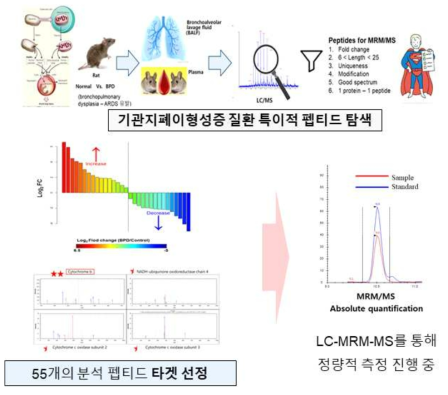 기관지폐이상형성증 질환 관련 마커 발굴