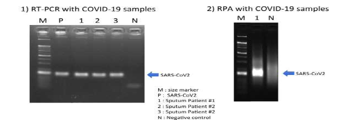 코로나 19 검출법 (RT-PCR)을 이용한 검출