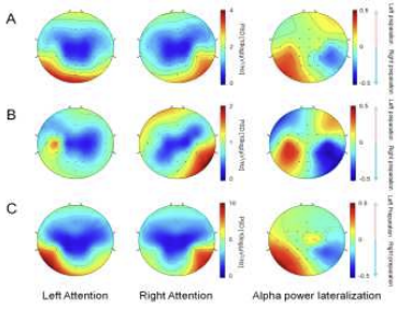 Subject의 Lateralization에 따른 Power distribution 결과