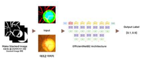 딥러닝을 이용한 녹내장 진단 과정