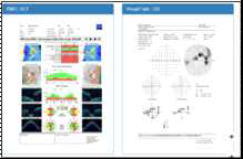 OCT,Visual필드 검사결과 조회