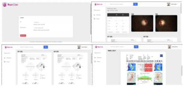 녹내장 및 당뇨망막병증 데이터 조회 구현 화면