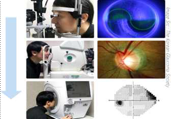 녹내장 검사 과정
