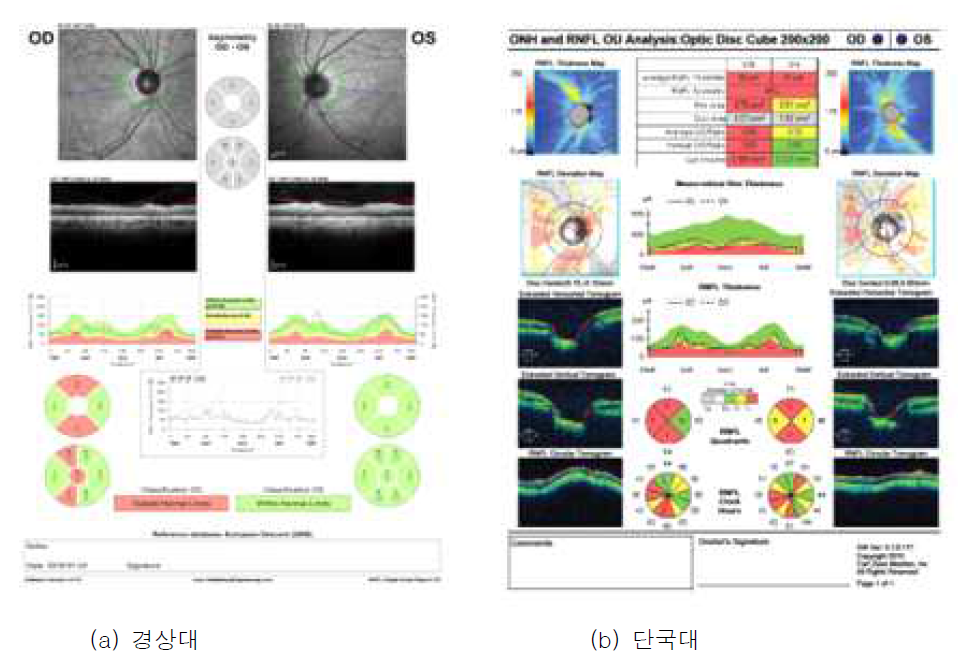 OCT 검사 결과 데이터