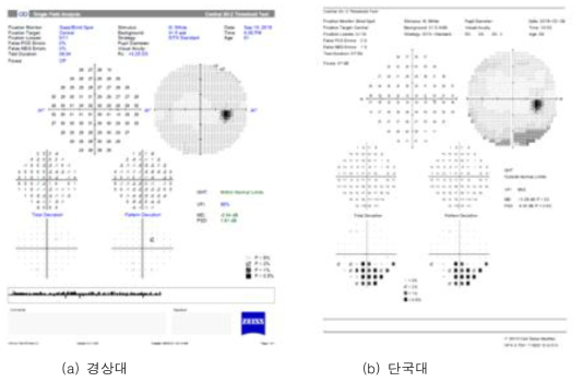 시야검사 결과 데이터