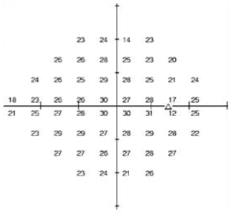 VSM(Visual Sensitivity Map)