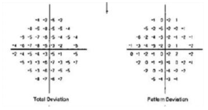 Total Deviation Map과 Pattern Deviation Map