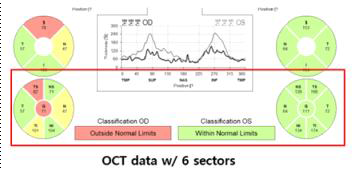 RNFL 6 Sector 수치 데이터