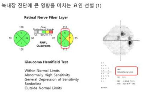 visual field test의 주요정보