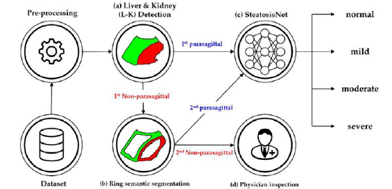 제안된 method의 flowchart. (a) Liver and kidney (L-K) detection이 1st parasagittal과 1st non-parasagittal로 분류 (b) Ring detection이 1st non-parasagittal 이미지를 다시 확인하여 2nd parasagittal과 2nd non-parasagittal로 재분류 (c) 1st 와 2nd parasagittal images가 지방간의 정도를 측정하는 SteatosisNet에 input image로 사용 (d) 2nd non-parasagittal image는 의사에 의해 분류