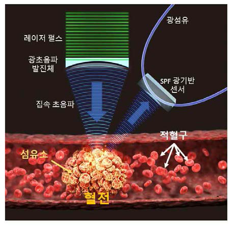 후방산란신호 획득 매커니즘