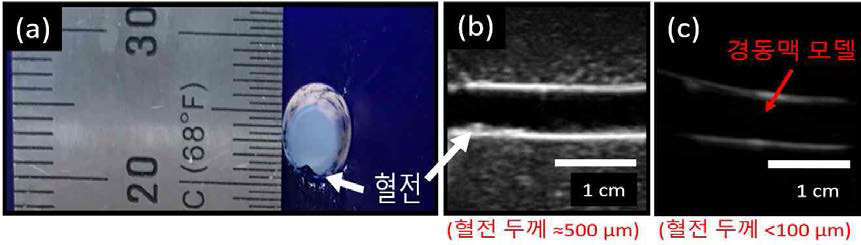 경동맥 모방 조직에 생성된 혈전 및 초음파 이미지