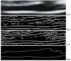 (a) original ultrasound image, (b) Sobel Filter, (c) Canny Filter, and (d) 5차년도 개발 NT 측 정 알고리즘