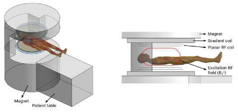 Open MRI 시스템의 수치해석 모델링