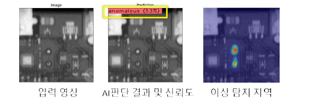 제작된 인공지능 이상 탐지 프로그램에 의한 엑스선 영상 분석