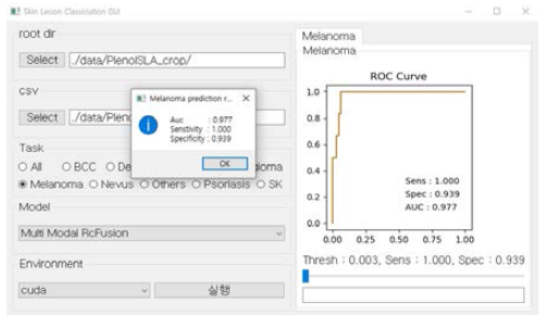 피부질환 3D 영상 진단 GUI