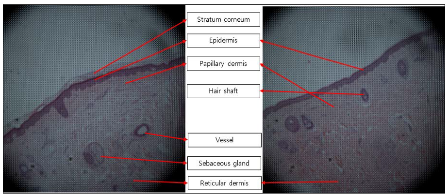 플렌옵틱 영상의 피부 부속기 구조확인