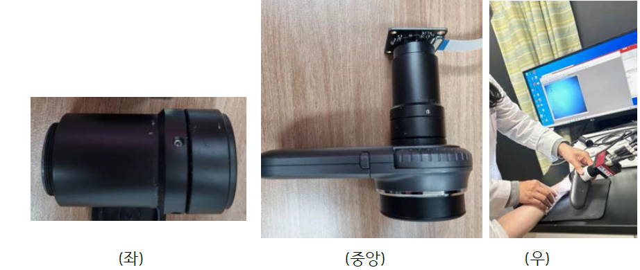 (좌) 제작된 인터페이스 광학계 (중앙) 플렌옵틱 보드카메라와 결합한 모습 (우) 피부질환진단에 사용하는 모습