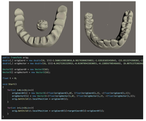 유니티에서 치아배열의 이동이 시뮬레이션 사례