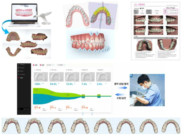 치료계획 시각화 모듈 개념도(안)