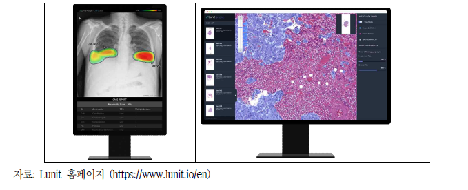 Lunit Insight, Lunit Scope 제품 활용 사진