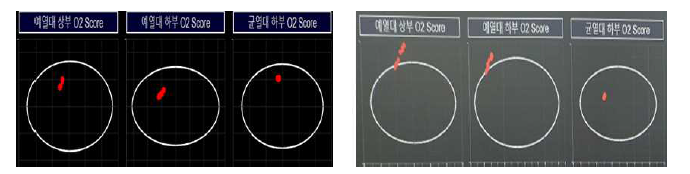 실제 운전 데이터 적용 사례: 정상 상태(좌)와 고장 상태(우)