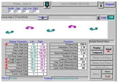 GAITRite 보행측정 Software