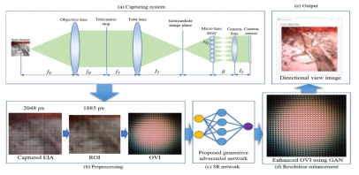 해상도 향상을 위한 GAN을 사용한 LF 현미경 시스템 (a) LF 현미경 영상 획득시스템, (b) 전처리, (c) GAN 을 사용한 학습, (d) SR 네트웍을 사용한 OVI 결과, (e) 해상도가 향상된 시점 영상의 예