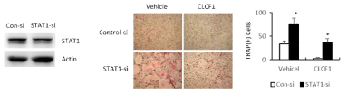 파골세포에서 STAT1을 통한 CLCF1의 작용