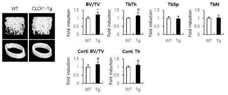 CLCF1 형질전환 생쥐의 골밀도 분석