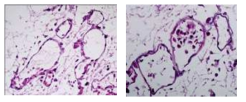 decellularized liver 매트릭스에 혈관 내피세포가 부착한 모습