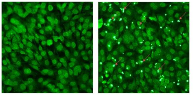 세포면역형광염색법을 이용한 staphylococcus aureus의 내재화 관찰. 좌측은 staphylococcus aureus에 감염되지 않은 골모세포이며, 우측은 staphylococcus aureus에 감염된 골모세포. ↓는 골모세포에 내재화된 staphylococcus aureus를 의미함