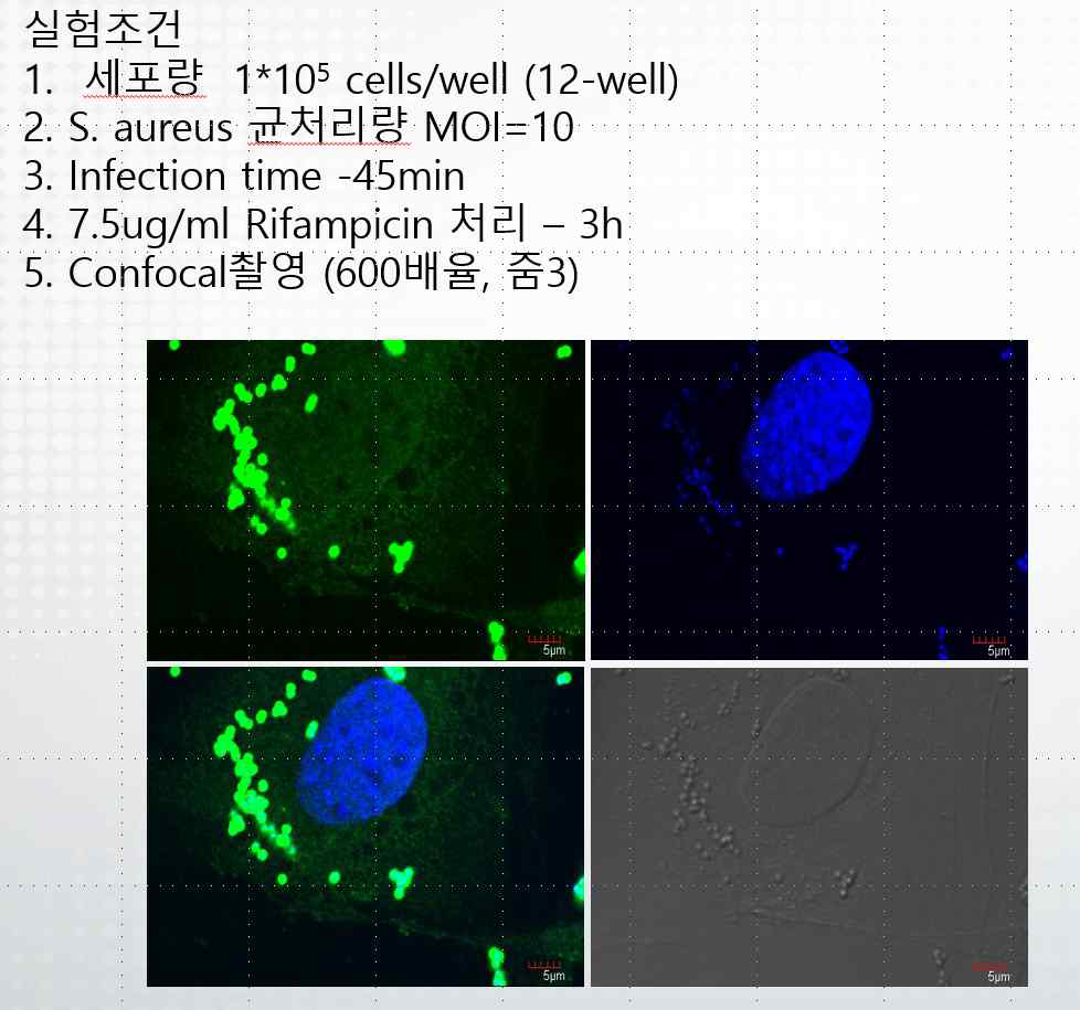 리파마이신에 의한 내재화균 소멸