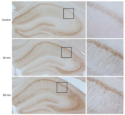 Phosphorylation of PI3K by the single administration of the extract of C. officinale in mice