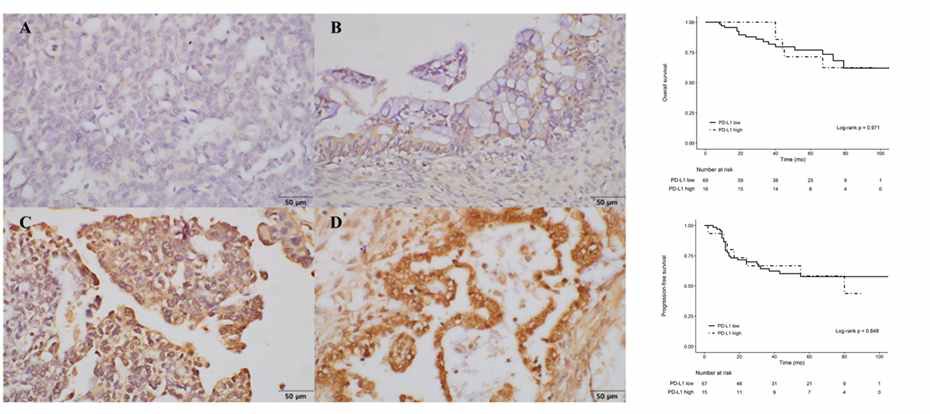 Immunohistochemistry (IHC) 및 생존률 분석 결과